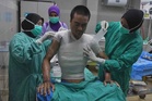 'Api membakar tubuh, berguling-guling atas tanah'
