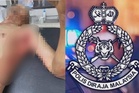 Warga emas cedera ditanduk lembu
