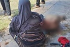 'Anak saya melecur akibat kemalangan dengan RXZ'