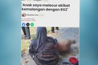 Remaja melecur akibat kemalangan dengan RXZ terpaksa ditidurkan