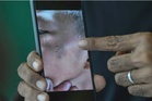 Budak 9 tahun lebam dakwa ditumbuk, dibuli pelajar senior