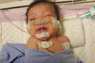 Bayi satu bulan perlu RM130,000 jalani pembedahan jantung
