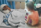 Budak lapan tahun cedera di kepala, leher diserang lima anjing liar