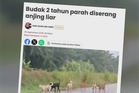 Nur Haira jalani tiga pembedahan, dipantau rapi pakar perubatan - Bapa