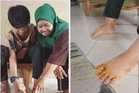 Lagi kes kanak-kanak diserang ajing liar: Alif keluar beli ubat, hanya 200 meter dari rumah