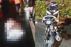 Dua rakan maut dilanggar, pemandu SUV serah diri