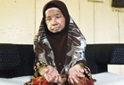 Warga emas derita scleroderma perlu telan 30 biji ubat sehari