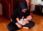 Bayi sembilan bulan jalani pembedahan kepala tiga kali