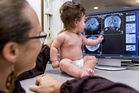 Otak bayi lebih kecil jika ibu alami anemia