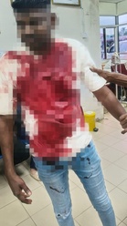 Lelaki cedera ditembak dua individu bersenjata api di stesen minyak