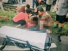 Dua pelajar maut, seorang parah nahas motosikal dan kereta