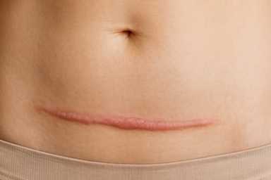 Almost 30% of babies in Malaysia are born via C-section, and may have weaker immunity!