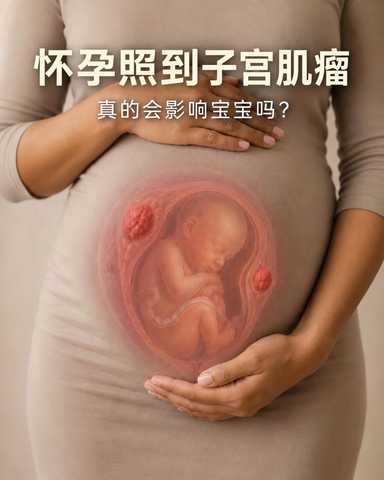 怀孕照到子宫肌瘤，真的会影响宝宝吗？