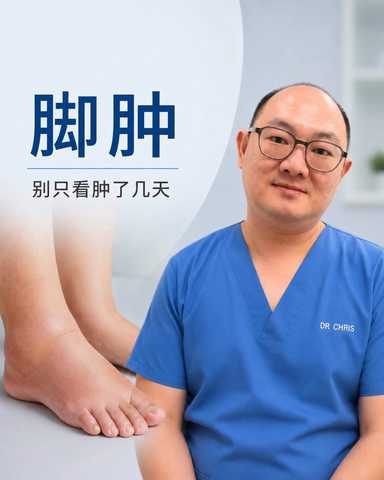 脚肿几天不重要，医生更在意这5件事