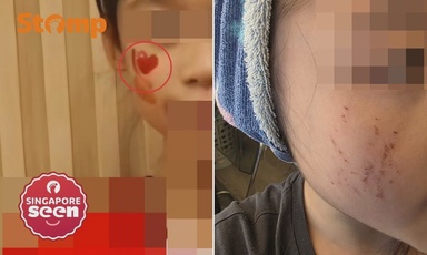 Child, 10, scratches face while removing National Day tattoo, mother says school could have handled matter ‘differently’