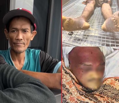 ‘Gambar ngeri’ dan kelewatan 18 jam beritahu keluarga: Peguam tuntut kematian tahanan polis disiasat sebagai kes bunuh