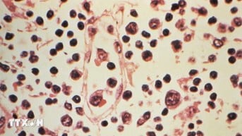 Hubungan Virus Hanta dan Warisan Ilmuwan Korsel Terungkap
