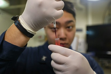 People Who Undergo Colorectal Cancer Screening Have Up to a 43% Lower Risk of Dying from the Disease