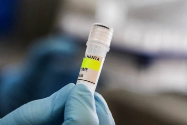 Hantavirus fears rising? Focus on preparedness, not panic, says Noor Hisham