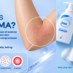 Eczema Awareness Month: Understanding Eczema the Triggers Behind the Itch