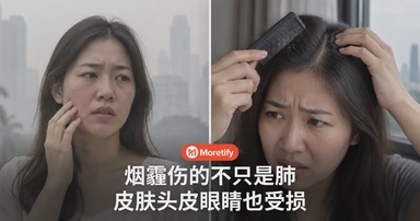 烟霾伤的不只是肺，皮肤、头皮和眼睛也在悄悄受损