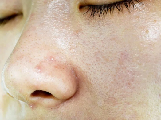 Image from: Bullies & Natural Beauty