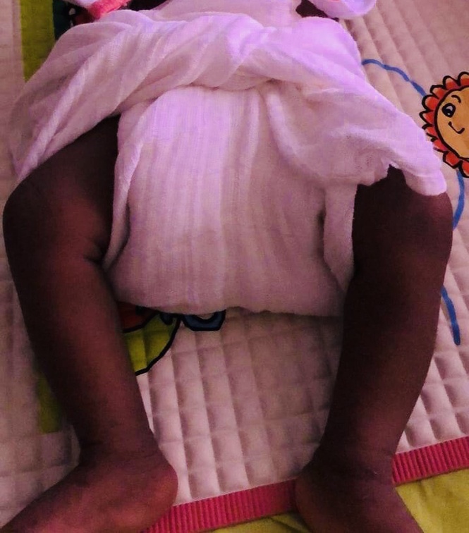 Image from: Napkins, Nappy? Does it still exist in our modern world?