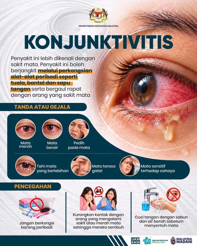 Image from: Konjunktivitis : Maksud, Jenis & Langkah Pencegahan