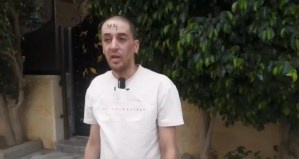Image from: Tentera Israel Tanda Nombor Pada Dahi Tahanan Palestin, Imbas Kembali Nostalgia Era Kejam Nazi