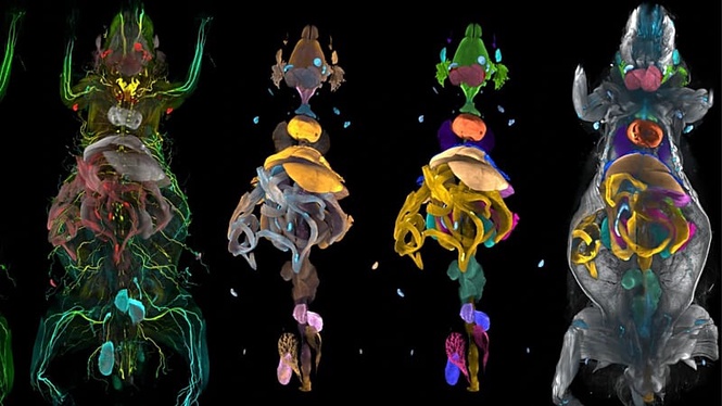 New AI atlas reveals how obesity affects the entire body