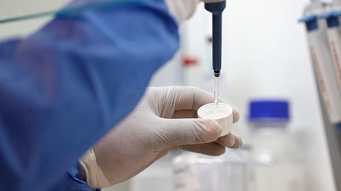 Pneumonic plague in Russia: What do experts say about the risk?
