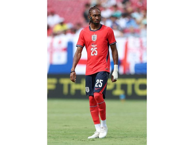 Image from: "Have to get used to it": Djed Spence to wear protective mask at FIFA World Cup after jaw injury