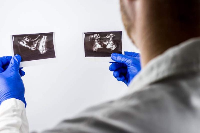 Image from: Why some men with prostate cancer may soon need only five radiotherapy sessions