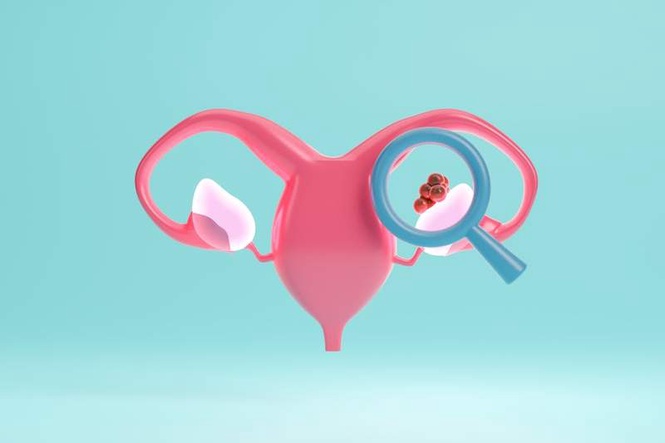 Image from: Ovarian cancer drug approved for NHS use will prolong lives