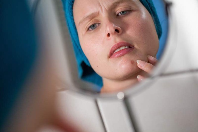 Image from: Pimple primer: Why you get spots (and how you get rid of them)