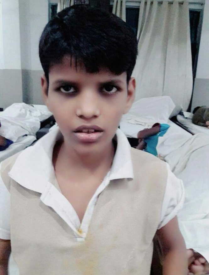 Image from: ‘Mowgli girl’, found wandering in UP forests nine years ago, dies at 18