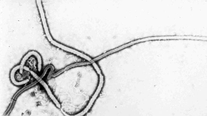 Image from: France confirms first Ebola case in doctor returning from DR Congo mission