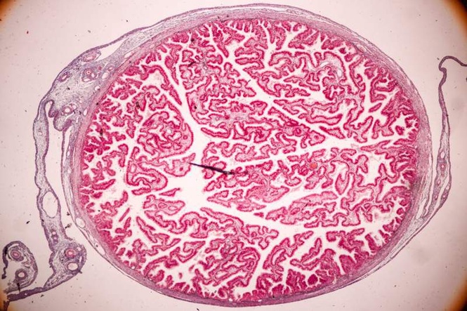 Image from: Placenta as property: why every mother deserves the right to choose