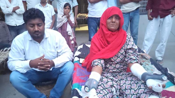 Image from: 60-year-old woman grabs jackal by jaws, fights it off with bare hands in Haryana’s Nuh