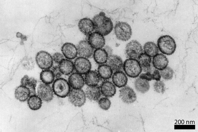 Image from: What risk of onward hantavirus transmission as variant identified?