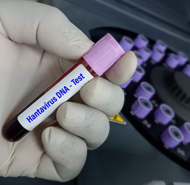 Image from: Unlike Covid-19, hantavirus not known for rapid human transmission, spreads through rodents: Experts