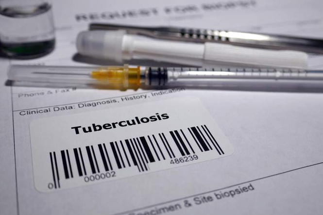 Image from: Hunger beneath the TB crisis: Study says 7,00,000 cases in India were avoidable