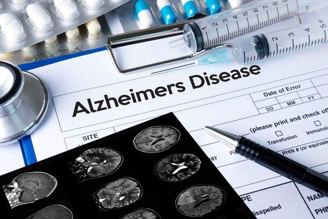 Image from: Changes in body fat due to obesity can contribute to Alzheimer’s disease: Study