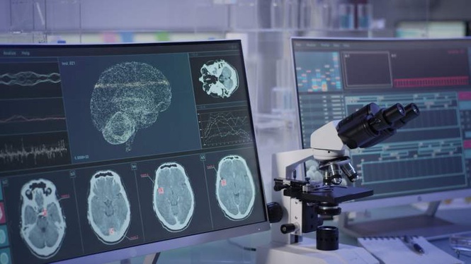Image from: IIT-Kanpur researchers study ‘relaxed’ brain activity to decode stress impact on cognition