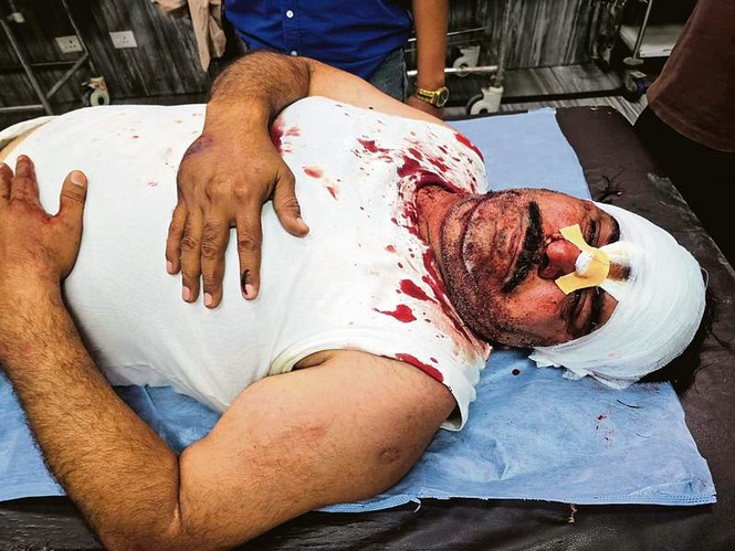 Image from: Punjab MC Elections: In Abohar, BJP worker attacked