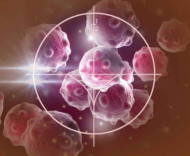Image from: Largest shortages in cancer workforce in 2050 could be nurses, diagnostic specialists: Study