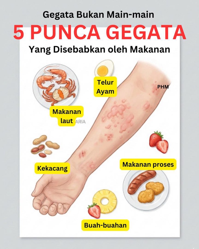 Image from: Gegata bukan main-main! 5 punca gegata yang disebabkan oleh makanan