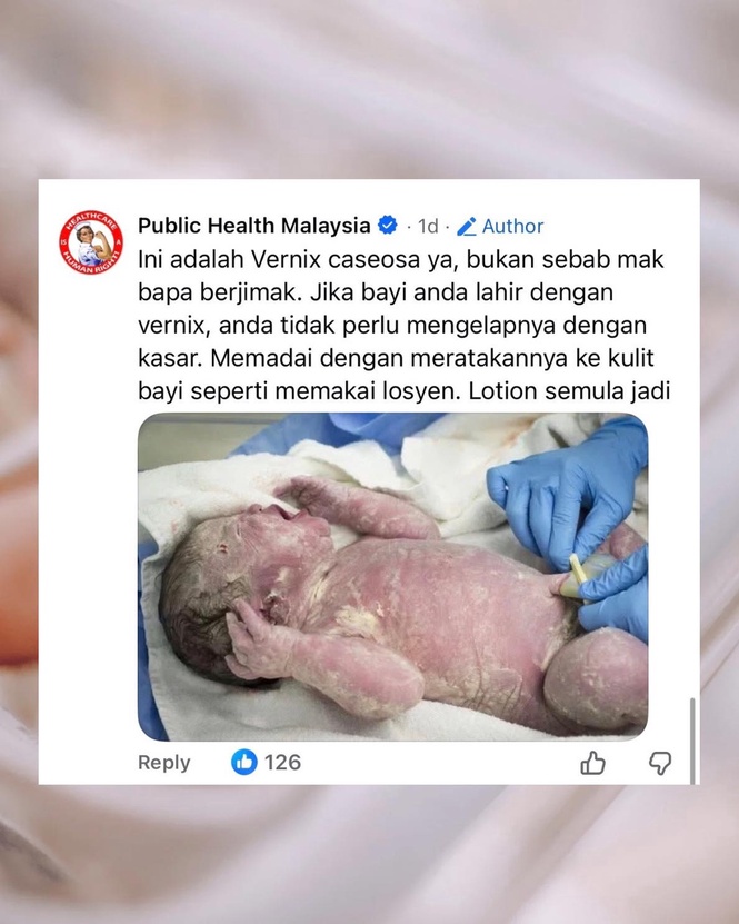 Image from: Lapisan putih pada bayi baru lahir? Ini penjelasannya