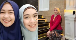 ria ricis hidung