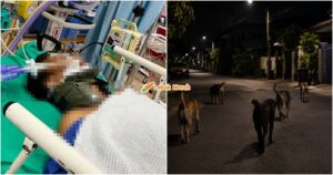 dikejar anjing koma cedera otak kekal